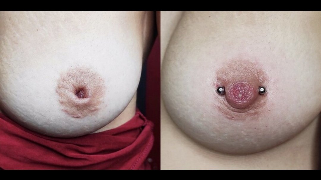 ak_darrell's tweet photo. Un piercing,

A volte può anche essere curativo 🙂

Correzione capezzolo introflesso con Piercing 💉
 #nipplepiercing #nipple #piercing https://t.co/G5hOrcbbx8