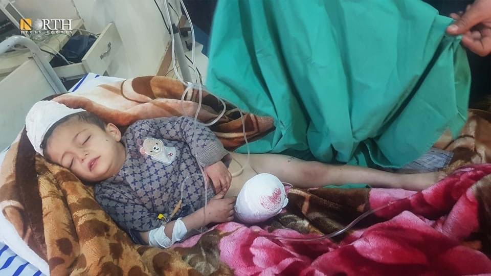 Giul_Granato's tweet image. Lui è Abdou Mustafa Hanifi.
Ha perso una gamba per le bombe turche sganciate su Kobane.

La 🇹🇷, membro NATO, dichiara che l'operazione militare ha per obiettivo i terroristi. I bambini?

Di queste bombe nessuno ne parla.
Di Maio men che meno.

Facciamolo noi. Facciamo girare.