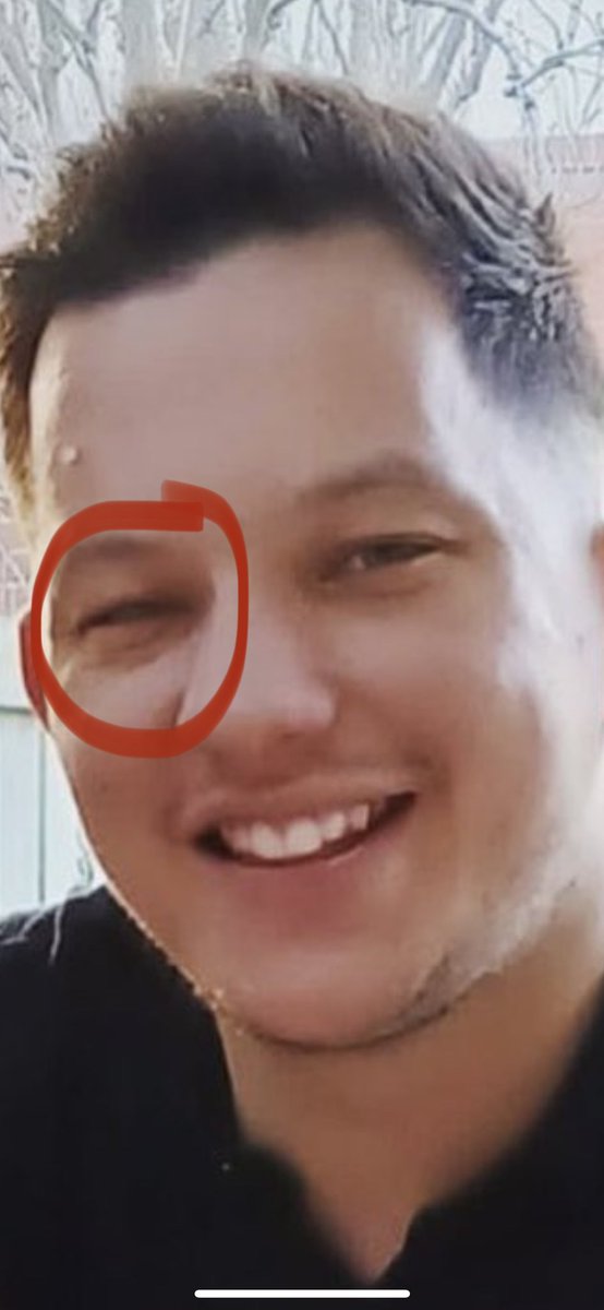 WeBoomBets's tweet photo. @adamLynch93 @KelvinLeGod1986 @sfc_ollie @SkySports Shall we talk about that eye?🤨 https://t.co/W4U3WT3Vpp