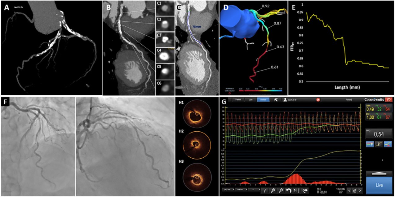 Radiology Cardiothoracic Imaging (RadiologyCTI) / Twitter