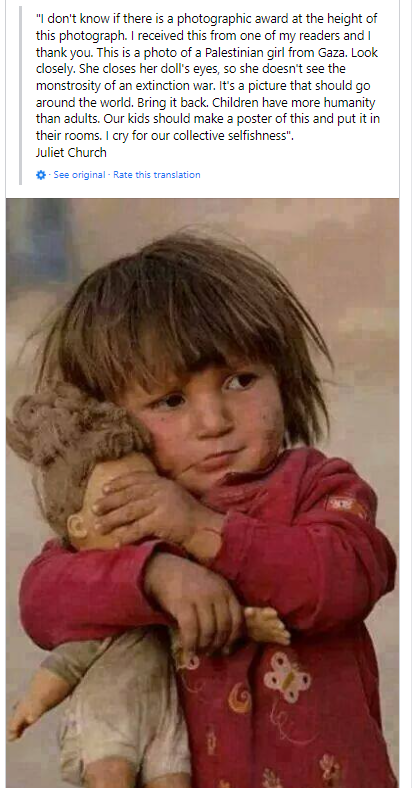 AnarchoZionist's tweet photo. More shameless lies from the "Israel is always wrong crowd", recycling a photo from 2007 and claiming it is a child from Gaza    #Pallywood https://t.co/dga6GKsO5N