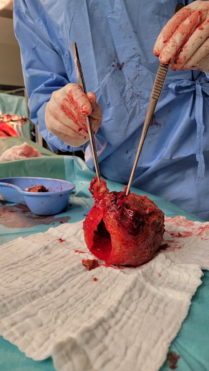 Vascular_USZ tweet media