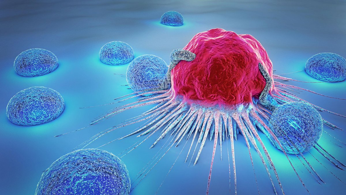 Institute of Oncology Research (IOR) (@ior_bellinzona) on Twitter photo 🧬Researchers of the Functional Cancer Genomics Group at the IOR, led by <a href="/JTheurillat/">Jean-Philippe Theurillat</a>, developed a novel method to track precisely prostate cancer progression.
📰Read the news: bit.ly/3qasIl1
🔬Article published on <a href="/NatureComms/">Nature Communications</a>: go.nature.com/3K7TClN
@MbolisDr 🧬Researchers of the Functional Cancer Genomics Group at the IOR, led by <a href="/JTheurillat/">Jean-Philippe Theurillat</a>, developed a novel method to track precisely prostate cancer progression.
📰Read the news: bit.ly/3qasIl1
🔬Article published on <a href="/NatureComms/">Nature Communications</a>: go.nature.com/3K7TClN
@MbolisDr