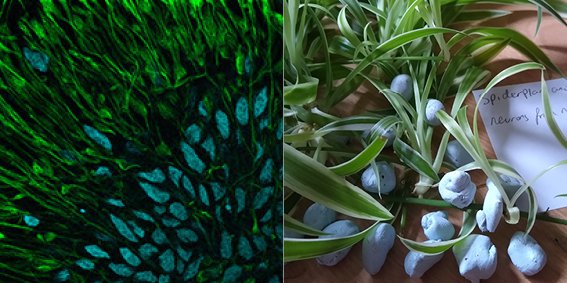 GSTTresearch's tweet photo. Did you know that it is #HouseplantWeekUK?
One of our #KHPSummerSchool alumni used houseplants to recreate brain cells imaged by @neuro_gaby.
There’s still time to apply to our new February 2022 Academy here: https://t.co/2itAz8mJ82
#IHeartResearchAcademy #RecreateScience https://t.co/v3mArw0opu