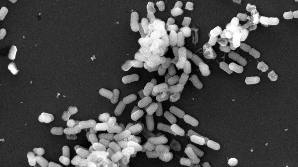 SSI efterforsker i samarbejde med Fødevarestyrelsen og DTU Fødevareinstituttet i øjeblikket et udbrud med en diarré-fremkaldende og toksinproducerende E. coli-bakterie. Udbruddet begyndte i dec. og omfatter lige nu 13 personer med mulig fælles smittekilde.
ssi.dk/aktuelt/nyhede…