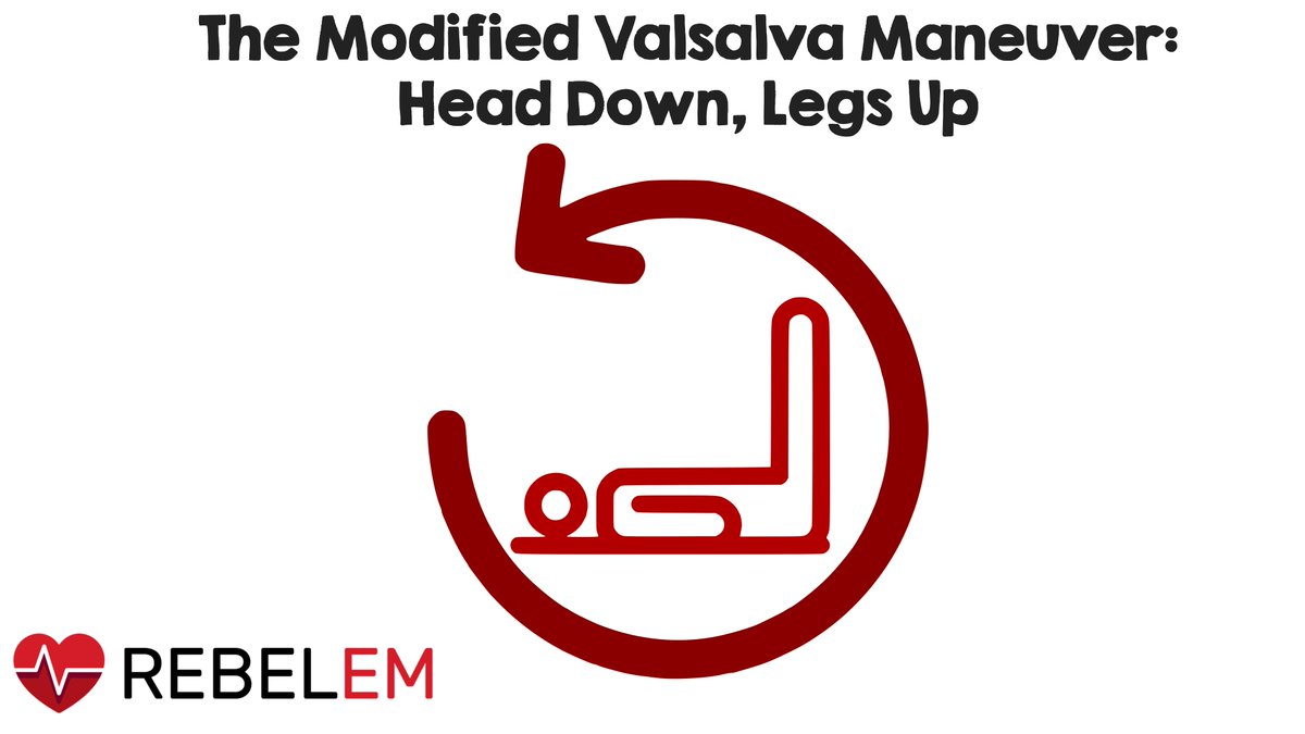 The Modified Valsalva Maneuver: Head Down Legs Up via <a href="/miguel_reyesMD/">Miguel Reyes, MD</a>

rebelem.com/the-modified-v…

#FOAMed #Valsalva