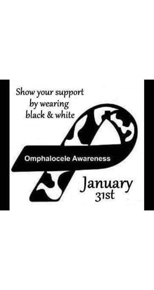 MsEdwina's tweet photo. Omphalocele Awareness Day is coming up soon 🖤 #Exomphalos #omphalocele #omphaloceleawareness #itsanOthing #Limerick #january31st https://t.co/QMjtFhb5pO