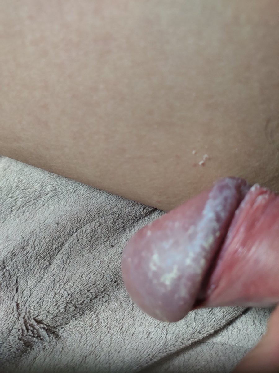 Smegmalover3's tweet photo. #smegma #dirtycock #dickcheese  #smellycock #dirty #dirtygay #sebo https://t.co/qUmgjhyxNU