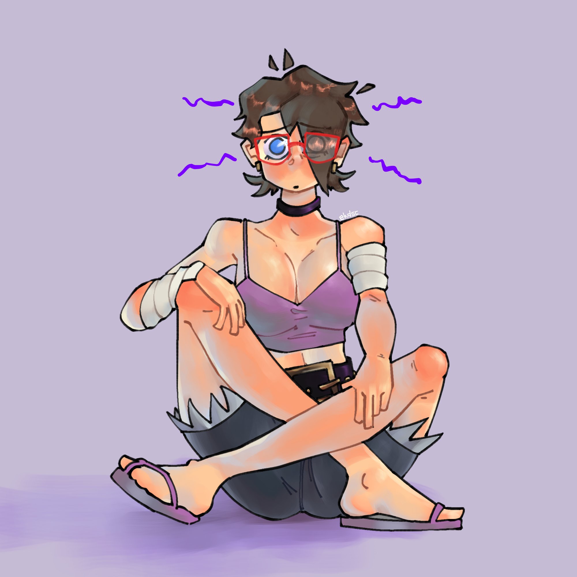 sunburn. owie.