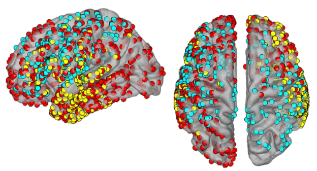 Nature Communications (@naturecomms) on Twitter photo Imagined speech can be decoded from human intracranial recordings, holding promise for people with severe speech production deficits
nature.com/articles/s4146…
<a href="/NeuDyLab/">Neural Dynamics Lab</a> <a href="/labgiraud/">Giraud Lab</a> Imagined speech can be decoded from human intracranial recordings, holding promise for people with severe speech production deficits
nature.com/articles/s4146…
<a href="/NeuDyLab/">Neural Dynamics Lab</a> <a href="/labgiraud/">Giraud Lab</a>