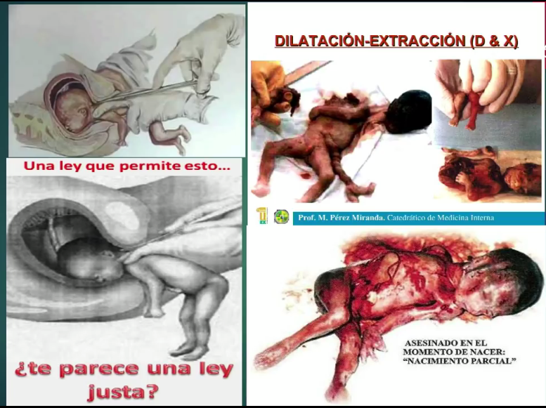 <a href="/eluniversocom/">El Universo</a> <a href="/JusticiaAN/">Comisión de Justicia y Estructura del Estado</a> <a href="/vicenteopi/">Vicente Ordóñez P.</a> Por si le interesa conocer el proceso para asesinar a un ser humano de 7 meses, aquí puede leerlo, la <a href="/JusticiaAN/">Comisión de Justicia y Estructura del Estado</a> lo sabe muy bien, igual los que aprueban, los que apoyan y por supuesto los carniceros que lo practican.