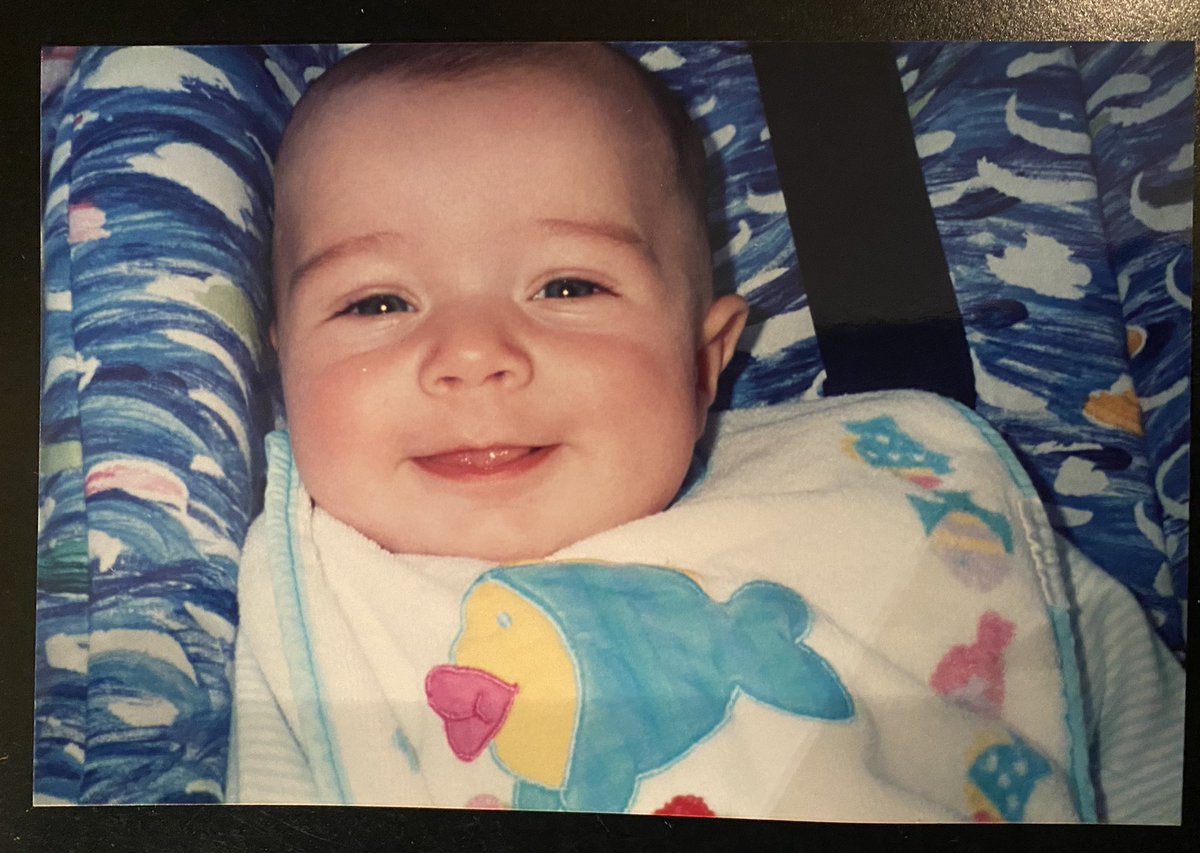 LeBard_'s tweet photo. almost 3 months premature and was incredibly tiny. Fed through a tube and lived in an incubator for a month. Premature babies have a 50% chance of survival. 38% are more likely to die before age 18. But fuck it, I just turned 25 https://t.co/Me7ELdG8dx