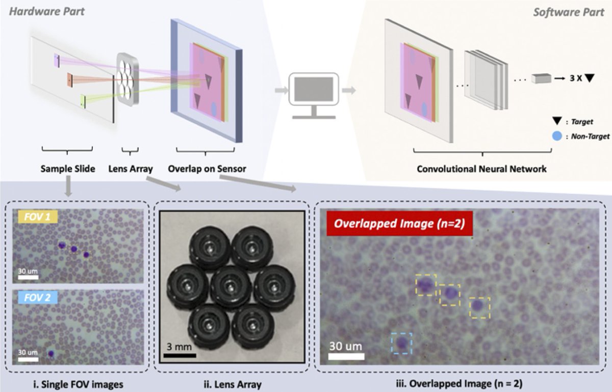 (1/2) In collaboration with <a href="/timwdunn/">Tim Dunn</a> lab, COL introduces a low-cost multi-lens microscopic system that can extract diagnostically-relevant features from different sample regions.