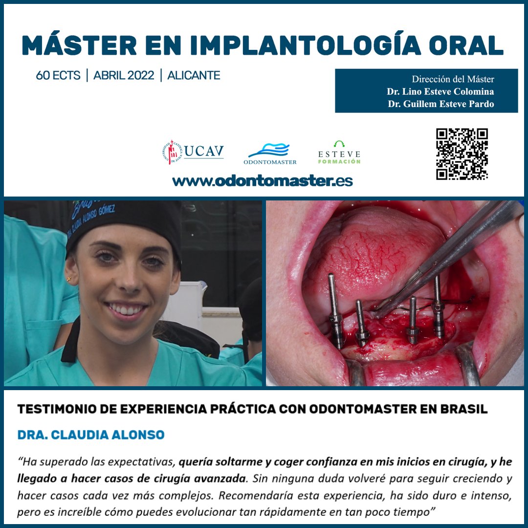 dr_emiliomunoz's tweet photo. Testimonio de experiencia práctica con Odontomaster en Brasil: Dra. Claudia Alonso.

Máster en Cirugía Oral, Implantología y Periodoncia.
60 créditos ECTS.
Sede Alicante.

https://t.co/dKmpg4Hygb
@odontomaster_es @ucavila_ @dr_emiliomunoz @esteveformacion https://t.co/UWcaRaacBQ