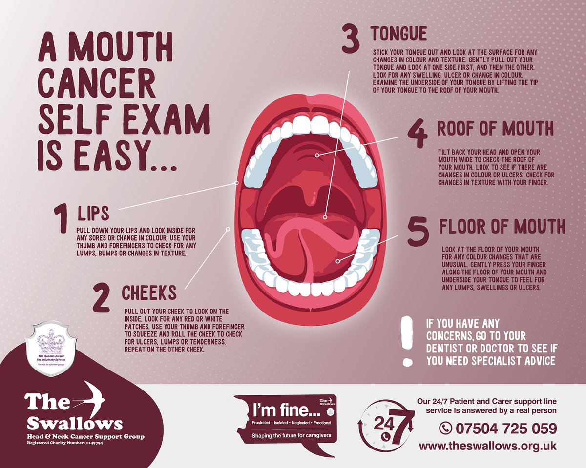 swallowsgroup's tweet photo. Checking your mouth on a regular basis could save your life, early Diagnosis can save lives RT https://t.co/yU3tfS5XCX