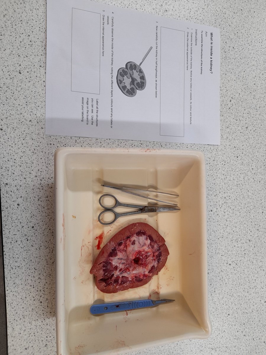 JubileeScience's tweet photo. Year 10 have been learning about how the kidneys work in Biology this week. @jubileehigh #handsonscience #kidneydissection https://t.co/VxdMviOPuE