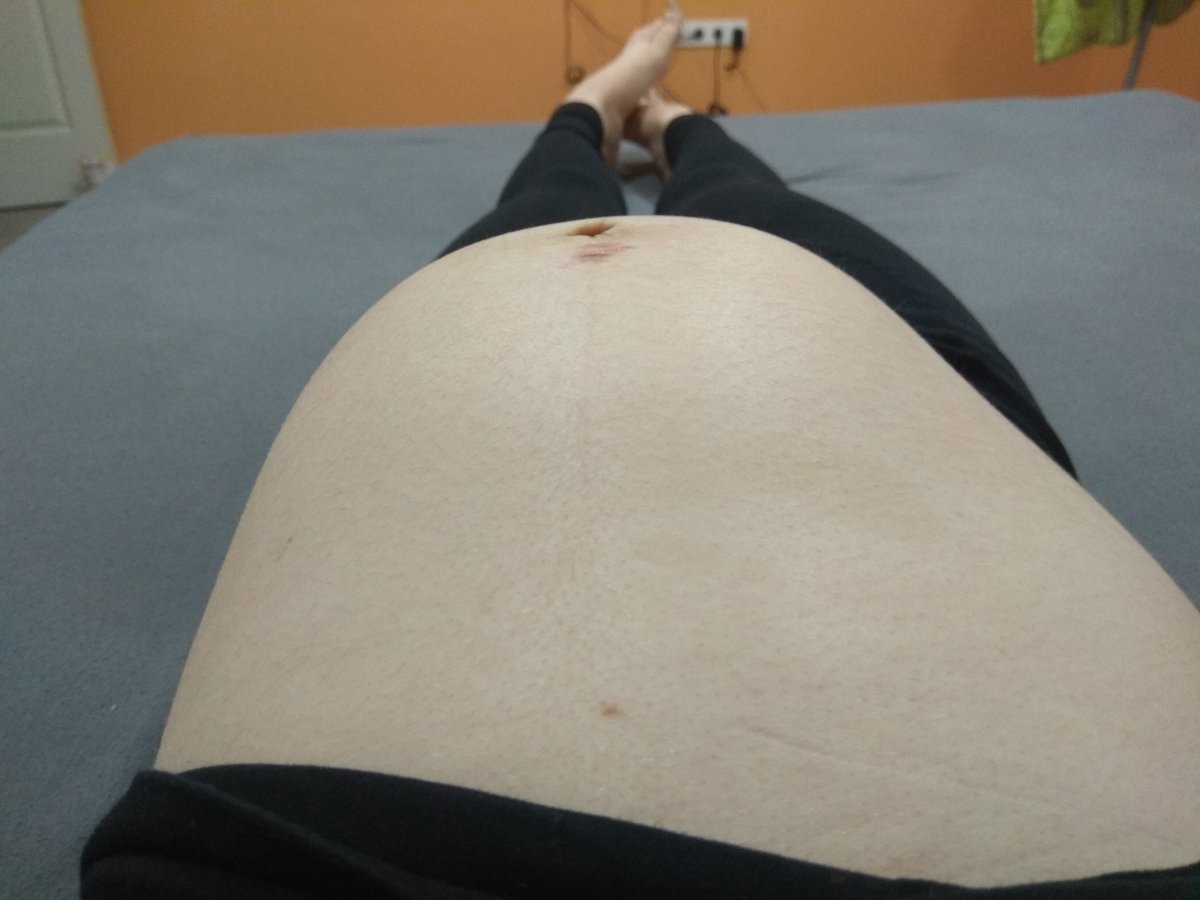ManyakFanny's tweet photo. Más pocakja: "jajj, de szép kerek, formás kismama hasad van!"
Én: " Szerintem, az én hasam berúgott..." 😂 https://t.co/lmr12m2grG