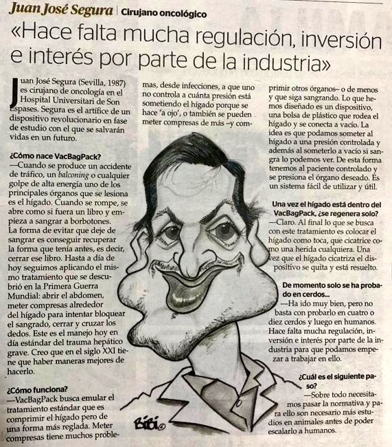 SeguraJuanJ's tweet photo. Gracias a @UHmallorca por hacerse eco de la labor que realizamos en @SonEspases.

Nuestro dispositivo para el trauma hepático continua avanzando, buscamos empresas que colaboren en su desarrollo. https://t.co/74mAXpIVKn