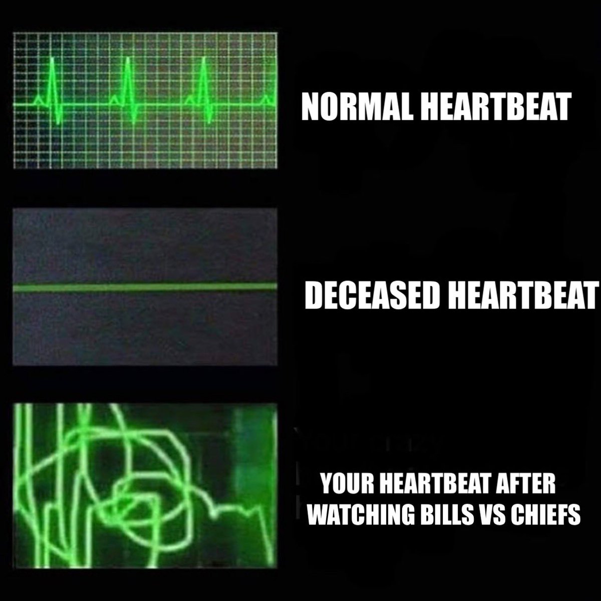 RT if you had a stroke