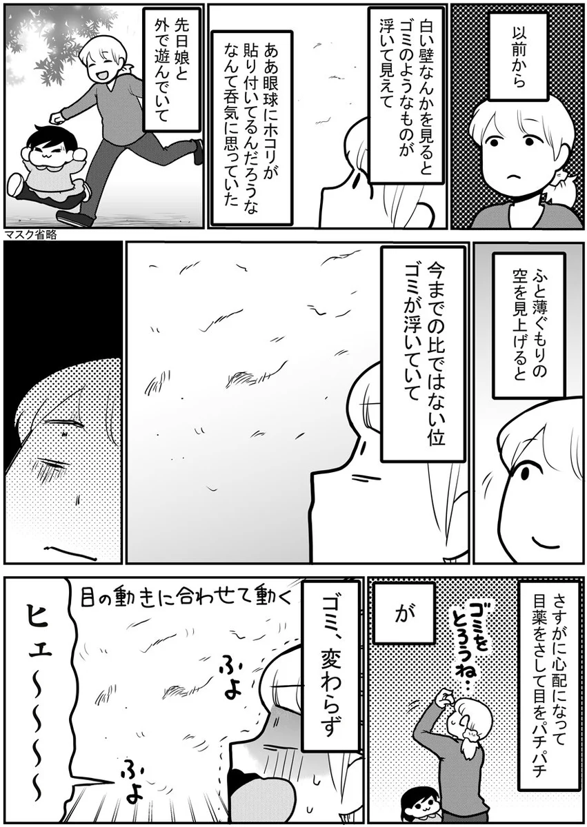 網膜剥離になったときの話！気になる症状がある方は早めに受診を！