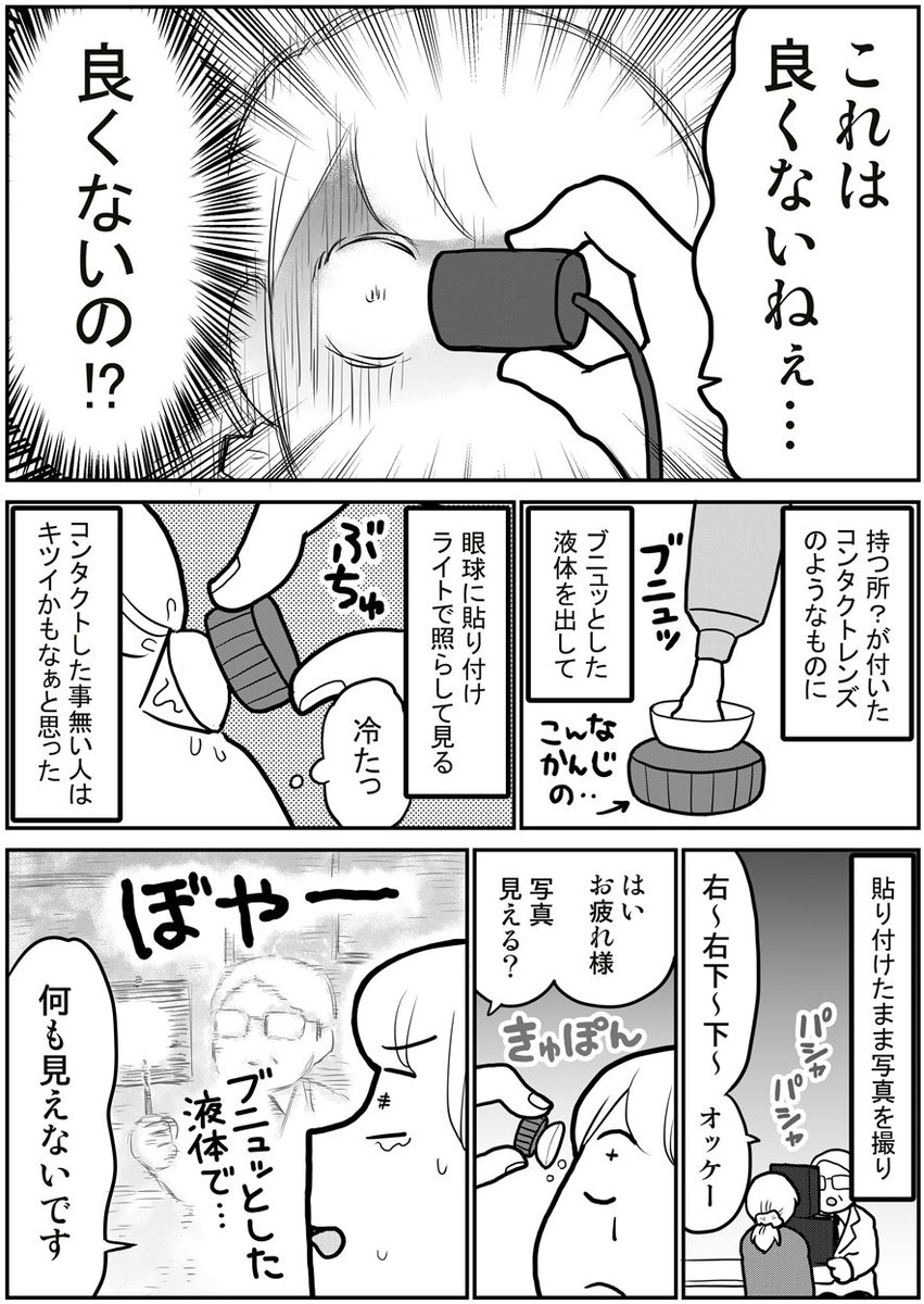 網膜剥離になった話(1/2) 