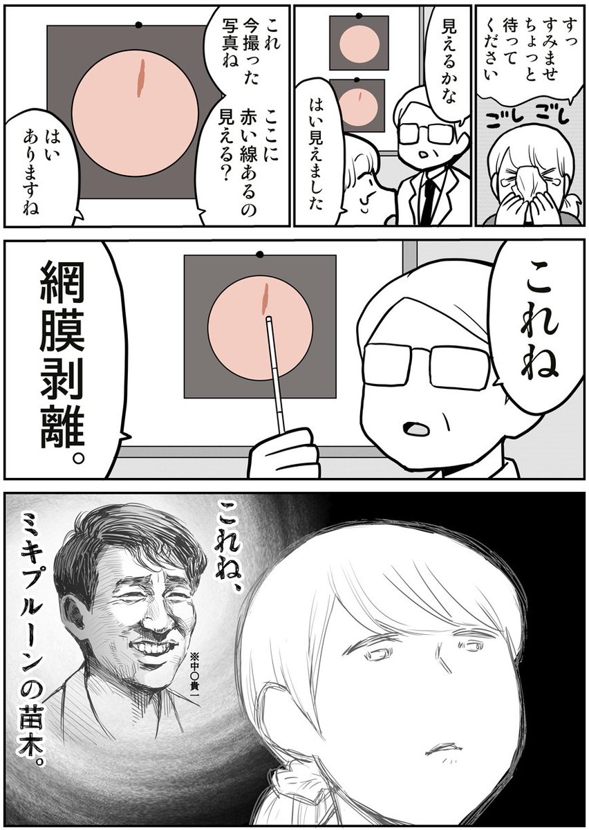 網膜剥離になった話(1/2) 