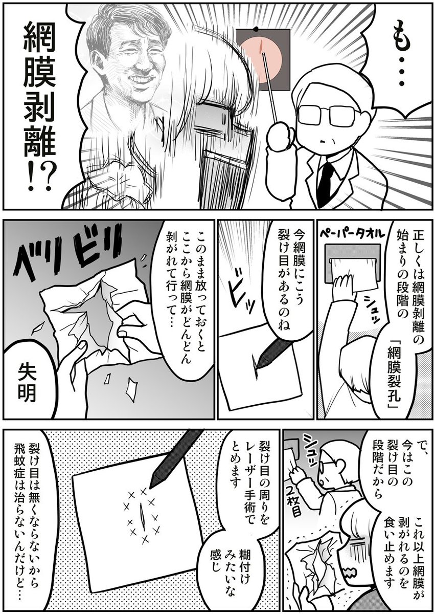 網膜剥離になった話(2/2) 