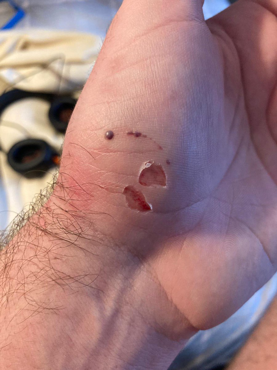 We’ve taken some time to ‘digest’ yesterdays action. A few handbags from our own and a couple ‘nibbles’ from <a href="/HAFC_1991/">Hethersett Athletic F.C.</a>… plenty of action to ‘get your teeth into’ as we’re all ‘chomping’ at the bit to get going again next week. Lost 5-4 (Mitch got bit)