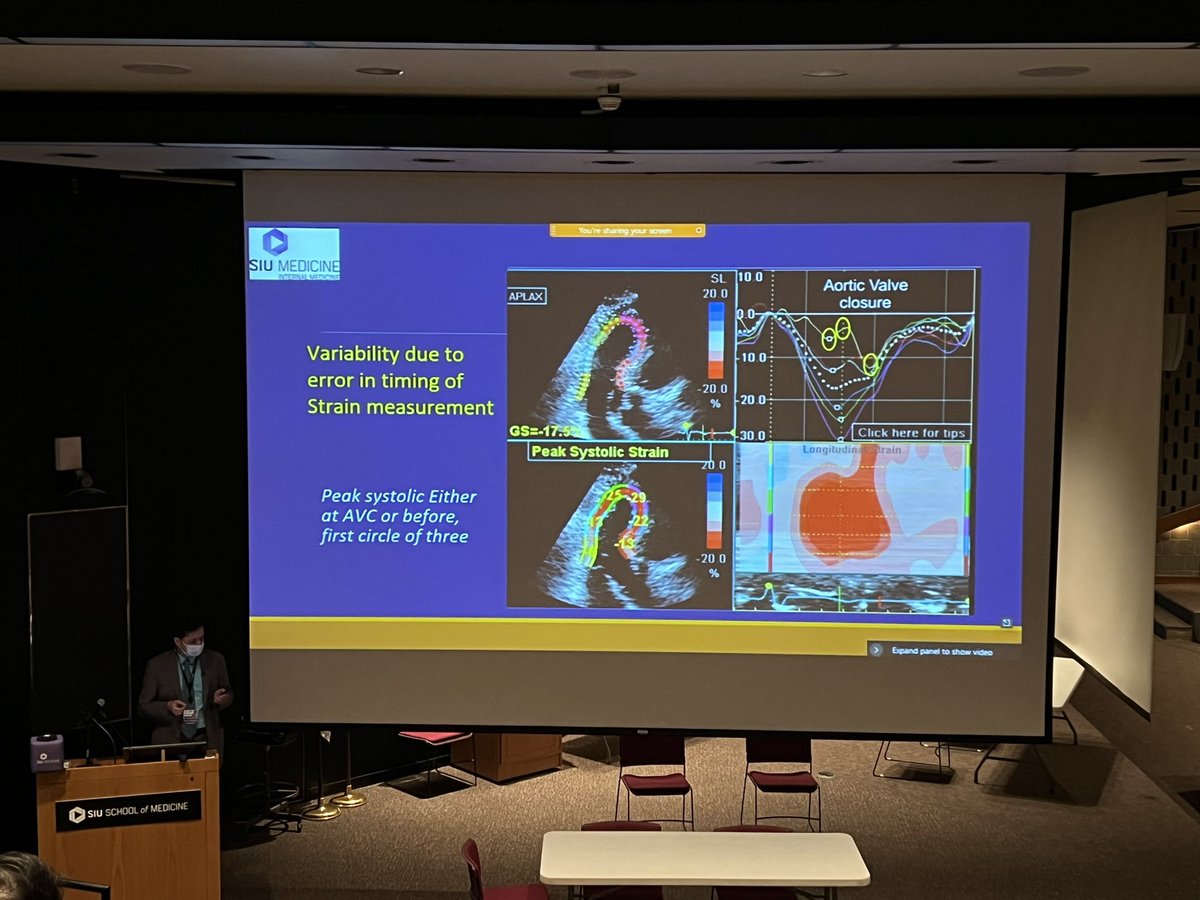 Abhishek Kulkarni (@abhikulk82) on Twitter photo Excellent presentation on Strain Imaging at SIU Cardiology Grand Rounds by <a href="/mukul_bhattarai/">Mukul Bhattarai</a> !! <a href="/siusom/">SIU Medicine</a> <a href="/moiz_hafiz/">Abdul Moiz Hafiz</a> <a href="/ManjariRRegmi/">Manjari R. Regmi 🫀</a> <a href="/mominsiddique01/">Momin Siddique</a> <a href="/madilsheikhMD/">M. Adil Sheikh</a> <a href="/balbast/">Basma Al-bast</a> <a href="/Mohsin_Salih19/">Mohsin Salih</a> <a href="/ChiefsSIU/">SIU Internal Medicine Chiefs</a> @AkcharAl <a href="/MDPatel21/">Raj Patel</a> <a href="/ShrutiHegde16/">Shruti Hegde</a> <a href="/YasserAlkhadra/">Yasser Al-khadra</a> Excellent presentation on Strain Imaging at SIU Cardiology Grand Rounds by <a href="/mukul_bhattarai/">Mukul Bhattarai</a> !! <a href="/siusom/">SIU Medicine</a> <a href="/moiz_hafiz/">Abdul Moiz Hafiz</a> <a href="/ManjariRRegmi/">Manjari R. Regmi 🫀</a> <a href="/mominsiddique01/">Momin Siddique</a> <a href="/madilsheikhMD/">M. Adil Sheikh</a> <a href="/balbast/">Basma Al-bast</a> <a href="/Mohsin_Salih19/">Mohsin Salih</a> <a href="/ChiefsSIU/">SIU Internal Medicine Chiefs</a> @AkcharAl <a href="/MDPatel21/">Raj Patel</a> <a href="/ShrutiHegde16/">Shruti Hegde</a> <a href="/YasserAlkhadra/">Yasser Al-khadra</a>