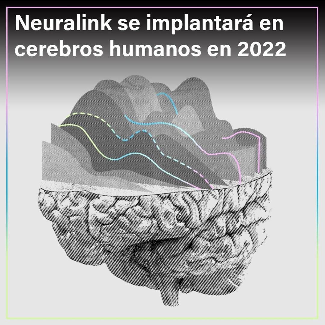 Cbioeticauc's tweet photo. 🔵Te invitamos a leer la nota preparada por Bioeticalab sobre la implantación del chip "#Neuralink" en el cerebro humano planificado para este 2022. ¿Qué opinas sobre las implicancias #éticas de este avance tecnológico?  Revísalo en ➡️ https://t.co/NxTefdOVZn
#AI #Ética #Bioética https://t.co/27IInp7OwP