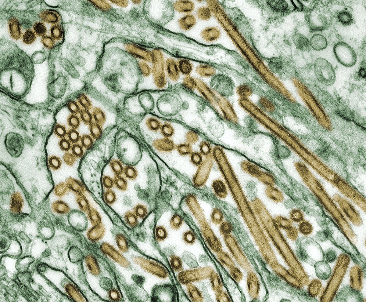 lisciencecenter's tweet photo. Learn why some germs make us sick while others are beneficial to our health. See how they spread and what you can do to help stop it. Advanced registration is suggested.  $20 per student, free for members. Additional admission for any accompanying family members ($15 per person) https://t.co/yxN7TtC10J