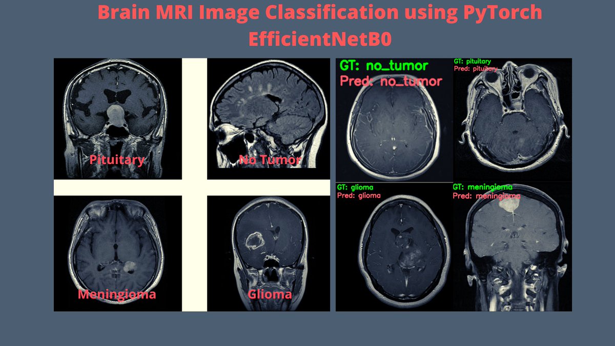 SovitRath5 (@sovitrath5) on Twitter photo debuggercafe.com/brain-mri-clas…
New post at DebuggerCafe - PyTorch EfficientNetB0 for Brain MRI Image Classification
#PyTorch #EfficientNet #EfficientNetB0 #TransferLearning #FineTuning #ImageClassification #DeepLearning debuggercafe.com/brain-mri-clas…
New post at DebuggerCafe - PyTorch EfficientNetB0 for Brain MRI Image Classification
#PyTorch #EfficientNet #EfficientNetB0 #TransferLearning #FineTuning #ImageClassification #DeepLearning