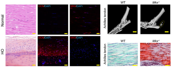 Achilles tendon is one of the most powerful and fragile tendons in human body. New findings from ZJU scientists provided a novel treatment for tendon heterotopic ossification.
zju.edu.cn/english/2022/0…

#ZJUResearch #tendontreatment