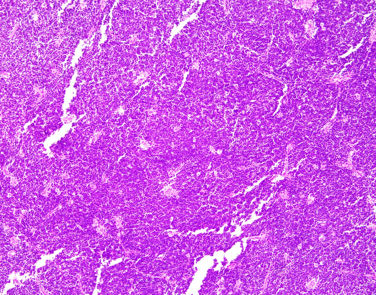 Brigham and Women's Pathology tweet media