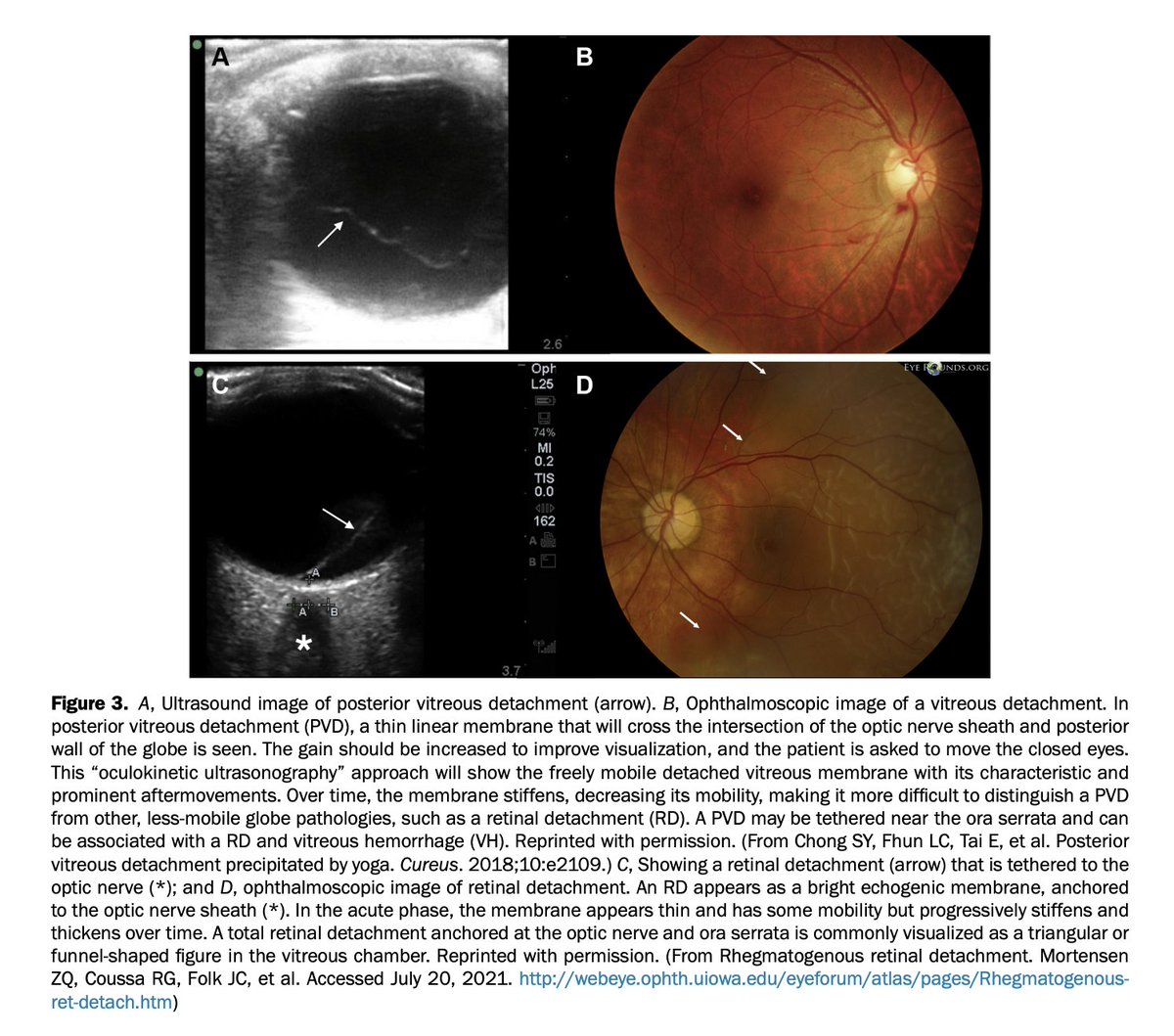 AnnalsofEM tweet media