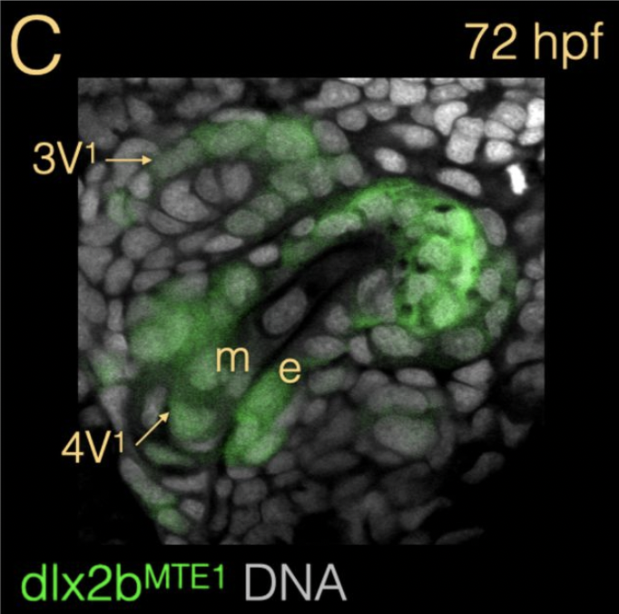 wjackman's tweet photo. Identification and characterization of a dlx2b cis-regulatory element both sufficient and necessary for correct transcription during zebrafish tooth development https://t.co/tppmGWuFzb https://t.co/Yl5t4vo0kM