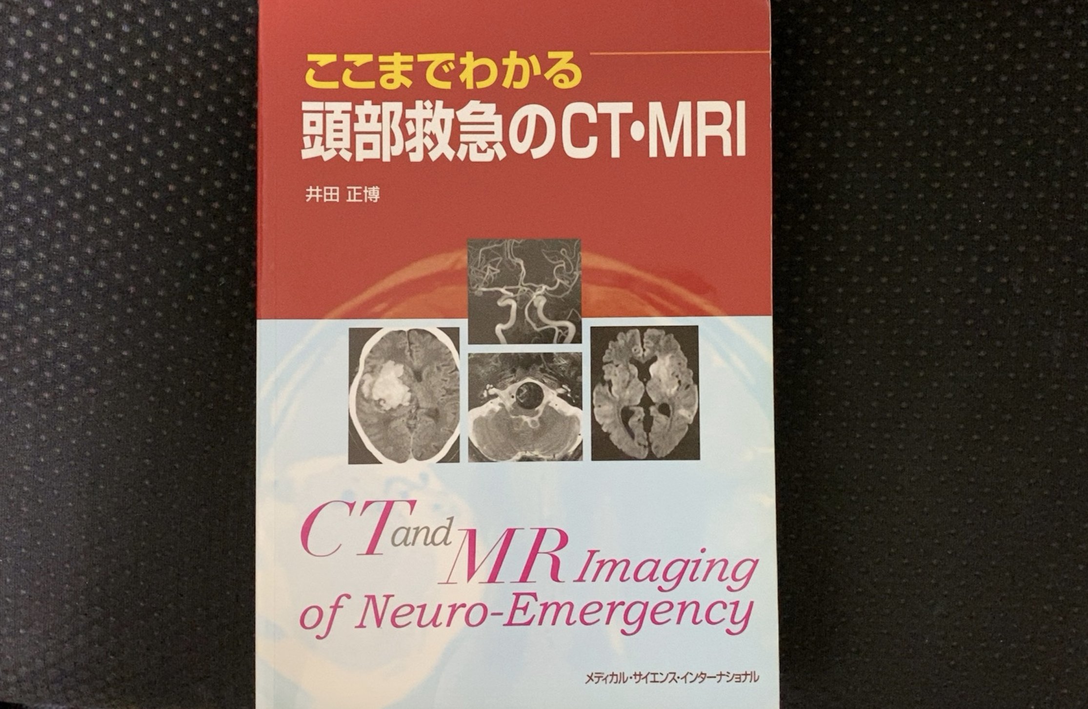 ここまでわかる頭部救急のCT・MRI | 井田正博 |本 | 通販 | Amazon