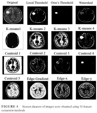 From #IET_IPR 'A combination of feature #extraction methods and #deeplearning for #brain #tumour #classification' bit.ly/3rQhylj @IET_Research #MRI #medicalimaging #neuralnetwork #glioma #featureextraction #tumourdetection