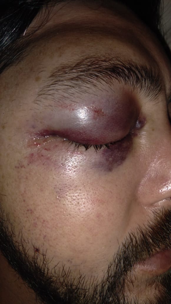 PortalInfoYa's tweet photo. Vejación y tortura a jóven de Madryn por parte de efectivos de Cría 4. Hasta el momento los torturadores siguen trabajando en @Policia_Chubut hasta cuando se va a permitir estos hechos? @dasnevesleo @arcionimariano 🤔🤔 le dieron hasta agua con lavandina luego de torturarlo🙄 https://t.co/2RWomiLUmp