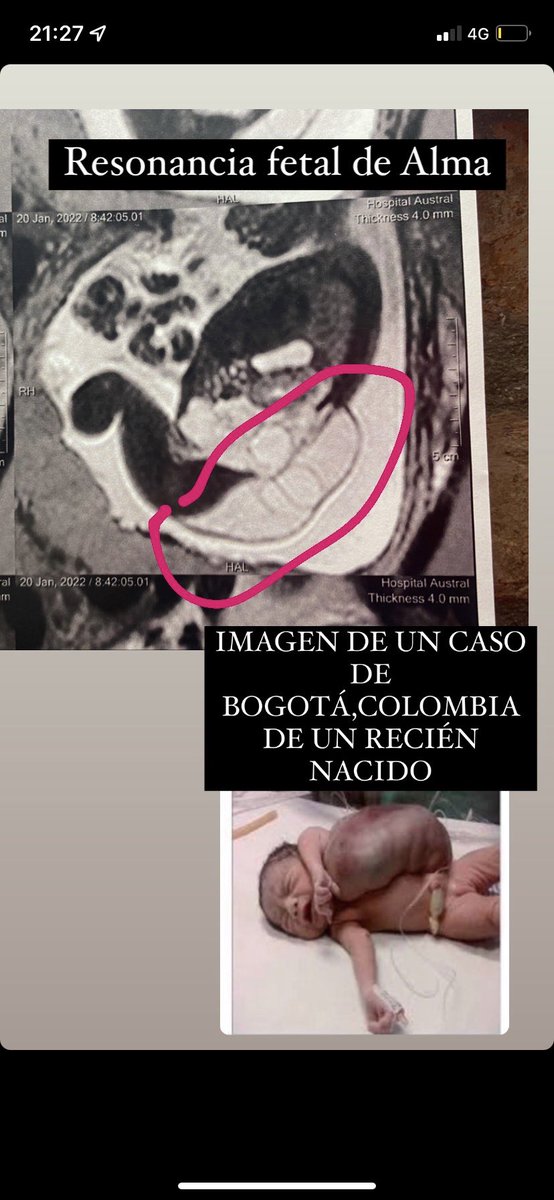 cami_santillan2's tweet photo. Necesitamos que nos ayuden 🙏🙏🙏❤️❤️❤️ https://t.co/2cL7qYgTJ7
