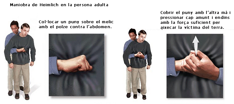 112's tweet image. #BonDia

Saps com actuar davant d’un ennuegament d'una persona adulta o d'un infant?

L’@icscat de #Valls t’explica la maniobra de #Heimlich 👇bit.ly/1fLMlaK