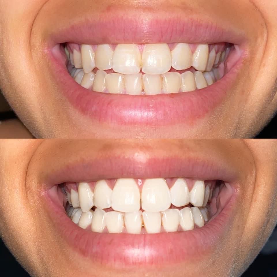 Forever_BlackZN's tweet photo. Please Rt🙏🏾  my hustle
AP24 Whitening Fluoride Toothpaste👏

BENEFITS 🌸
◼ A secret to a PERFECT SMILE
◼ Prevents Cavities
◼ Removes stains &amp; fight plague 
◼ Gives you a pearly WHITE TEETH &amp; FRESH BREATH🤗

PRICE: R175 

TO ORDER⬇️
Whatsapp 📲 0730594302
🚚 R60 DELIVERY https://t.co/MR5SFQbT7y