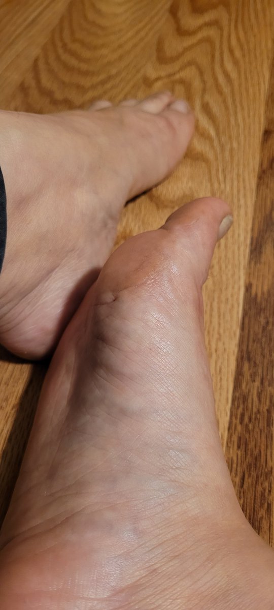 TipseaToes's tweet photo. These babies are ready for tomorrow's pedicure!!! What color should I get? And does anyone else see my cute ass foot dimple?

#TimeForAPedicure #FootDimple  #NakedFeet #FootFetish #soles #SoleFetish #arch #nailpolish https://t.co/LuYqOJahpB