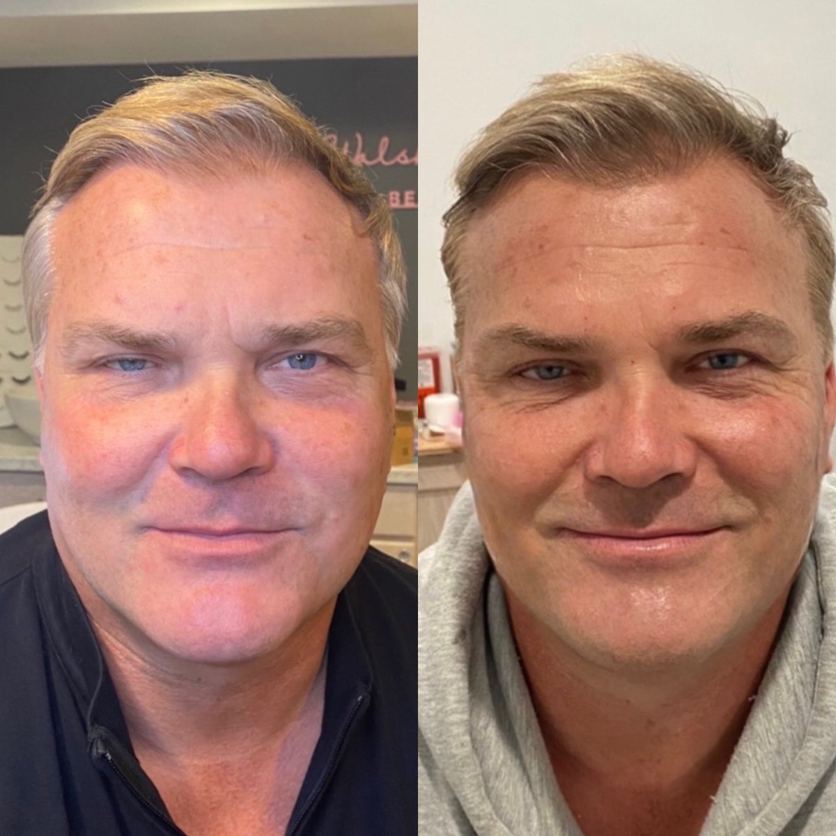 ARN Medical Aesthetics tweet media