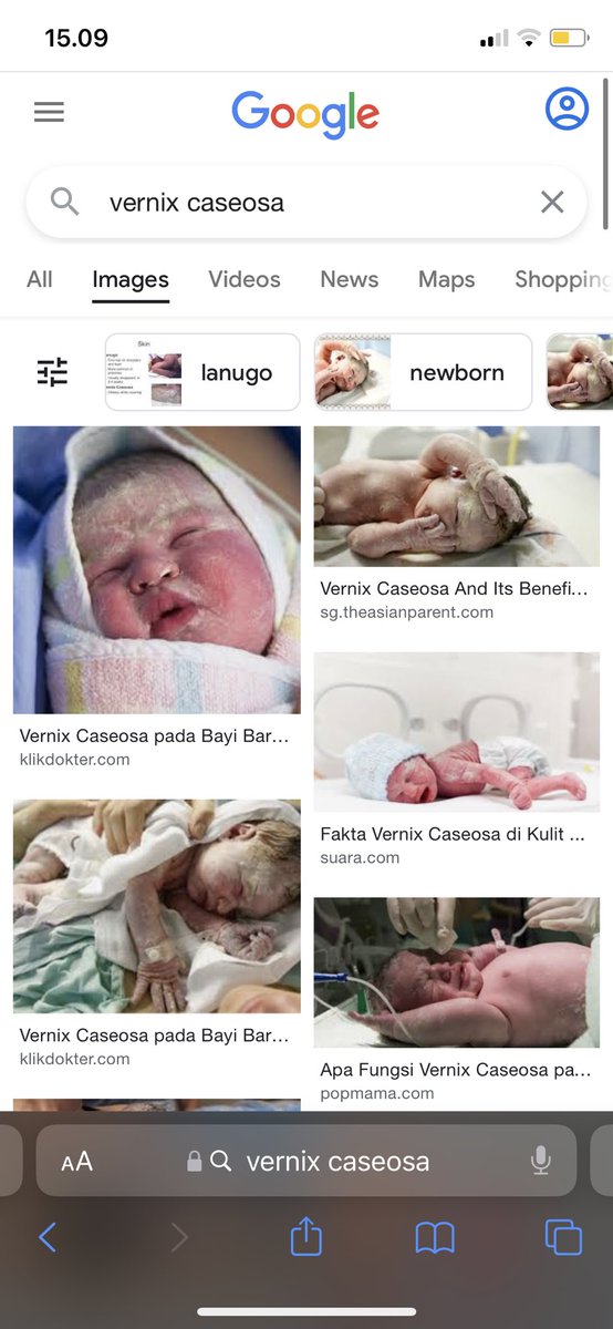 Pernah liat lapisan lemak yang menyelubungi bayi baru lahir? Jangan langsung dibersihkan ya, itu vernix caseosa, lapisan biofilm canggih yang mampu menjaga hidrasi, pH, dan benteng infeksi di hari2 pertama kehidupan. Ada yang bisa nebak saya mau bahas apa di #utasanak kali ini?😬