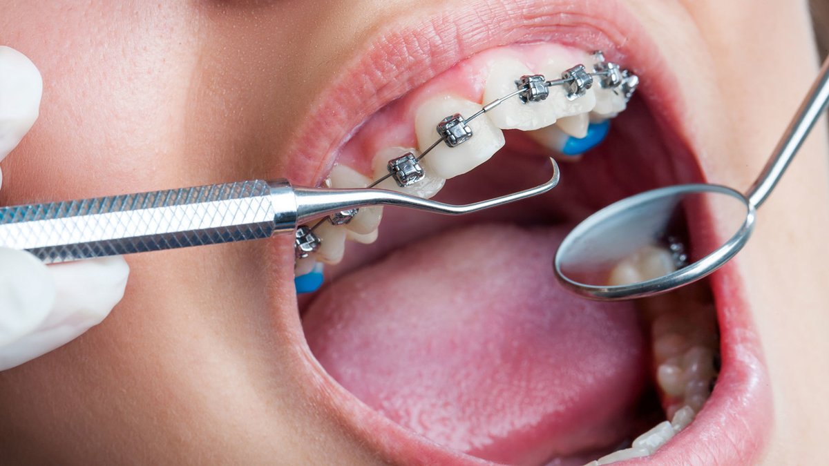 nV_Violet's tweet photo. https://t.co/iXDvuV55P0

https://t.co/SbP8KWdX4j

Best Cosmetic dentist in Anthem Az are here https://t.co/oZE2AlPRzh