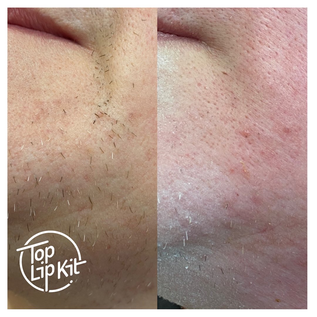 TopLipKit1 tweet media