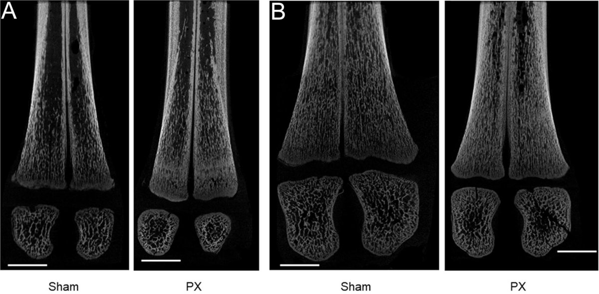 Check out this new #openaccess research from the January issue on how #pancreas deficiency modifies #bone development. It is authored by Alison J Forhead et al.  <a href="/PDN_Cambridge/">PDN Cambridge</a> <a href="/brookeshls/">Oxford Brookes HLS</a> 
Read in full: ow.ly/jOQs50HwQZh