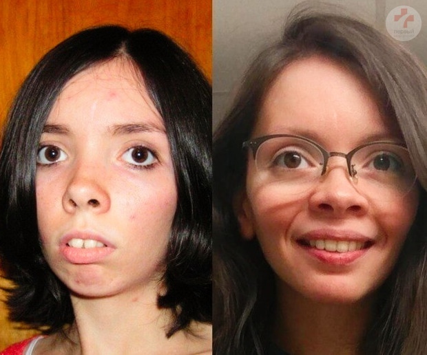 Лицо после похудения. Старение кожи лица. Меняется ли человек с возрастом. Люди которые стали красивыми. Изменение внешности с возрастом.