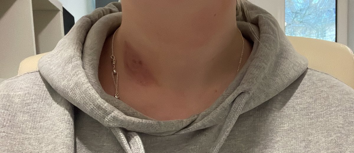 hazecals's tweet photo. tw nsfw 

„i only sucked lightly and far down“ 🤨😐😐😐😐 BRO NO and i have shit healing too and i see my parents this weekend?????? https://t.co/Tagbdiggb4